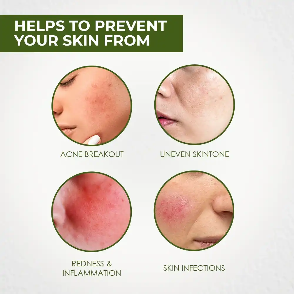 Tea Tree & Neem Anti-Acne and Pimple Clear Super Serum - Image 3